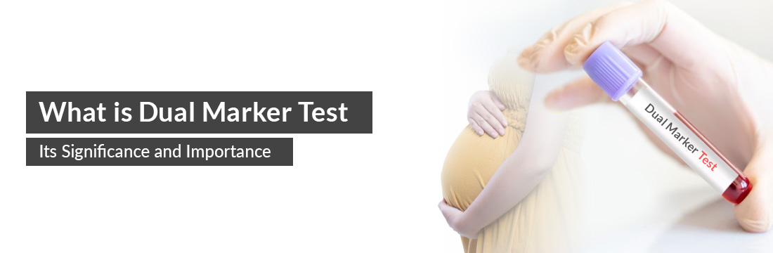  What is Dual Marker Test, Its Significance and Importance